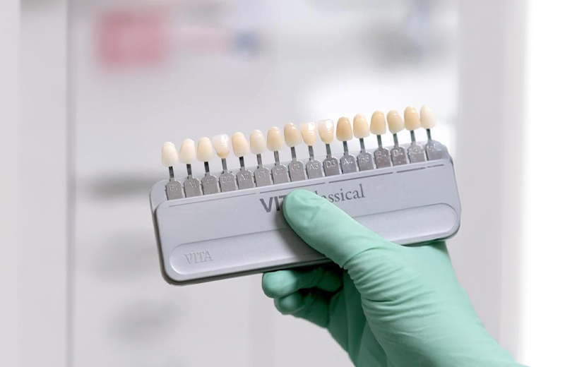 Laser Teeth Whitening
