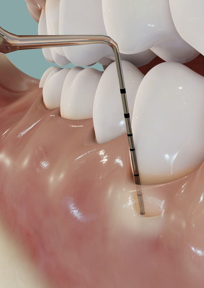Gum & Bone Treatments