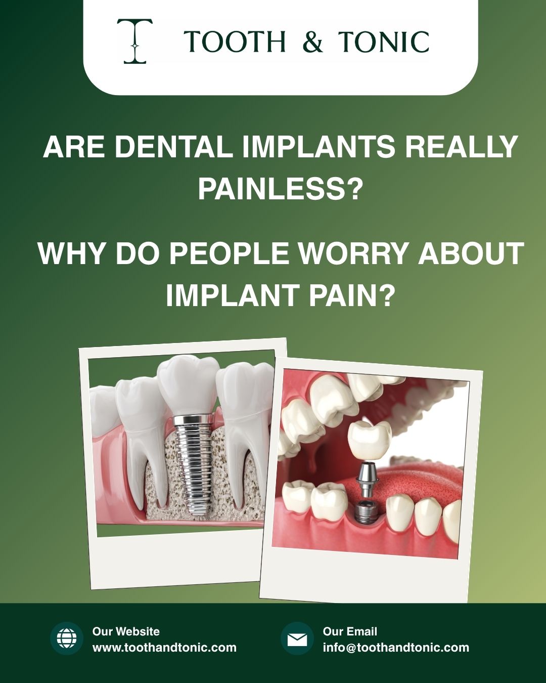 Are Dental Implants Really Painless?