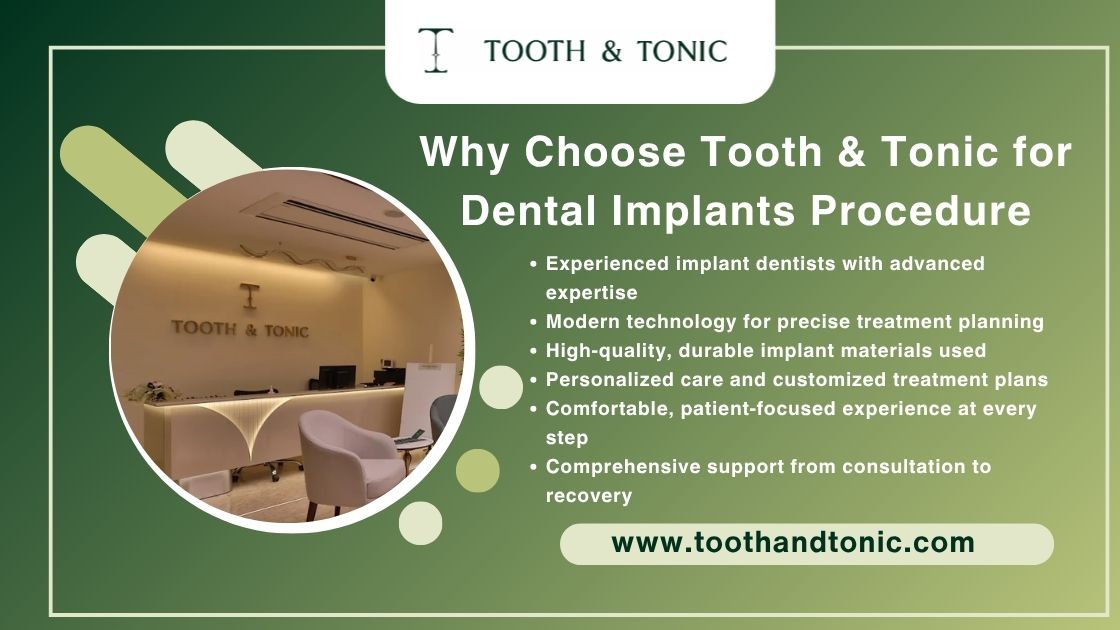 Why Choose Tooth & Tonic for Dental Implants Procedure