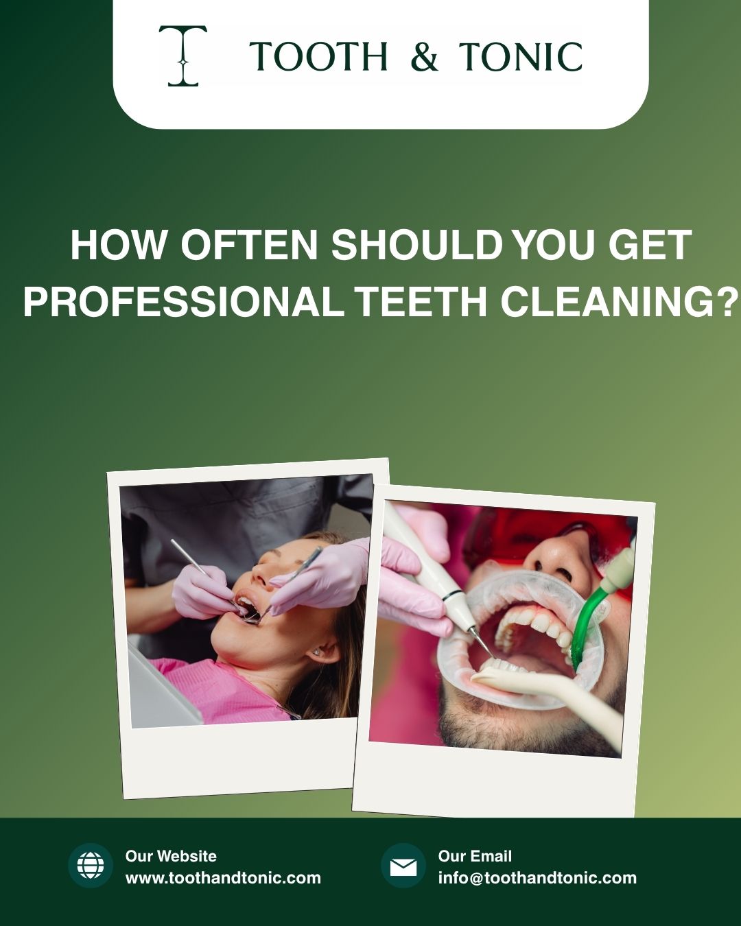 How Often Should You Get Professional Teeth Cleaning?