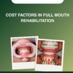 Cost Factors in Full Mouth Rehabilitation