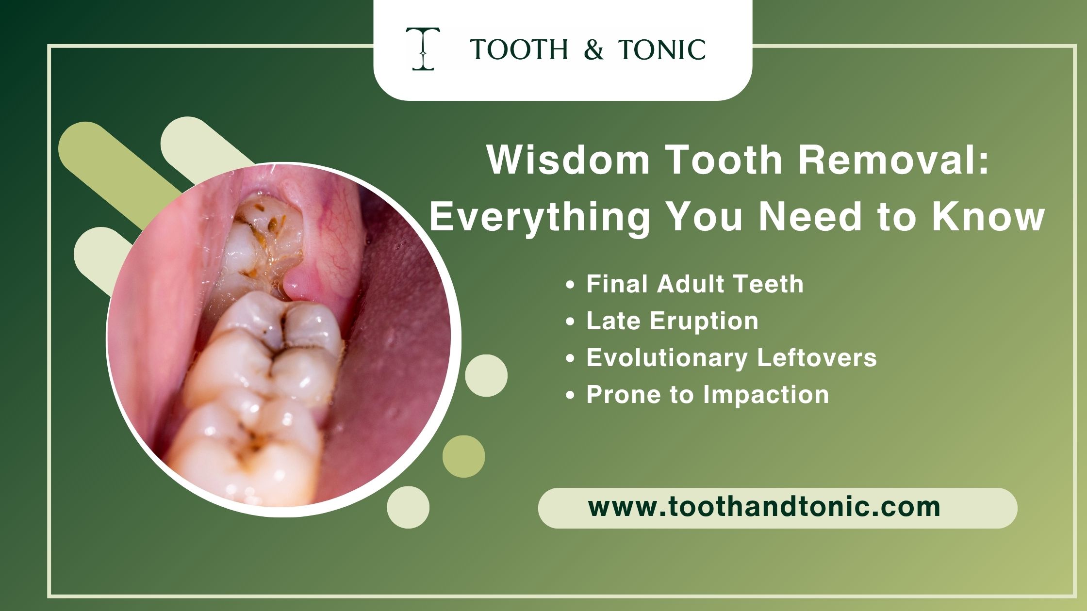 Wisdom tooth position inside the upper and lower jaw