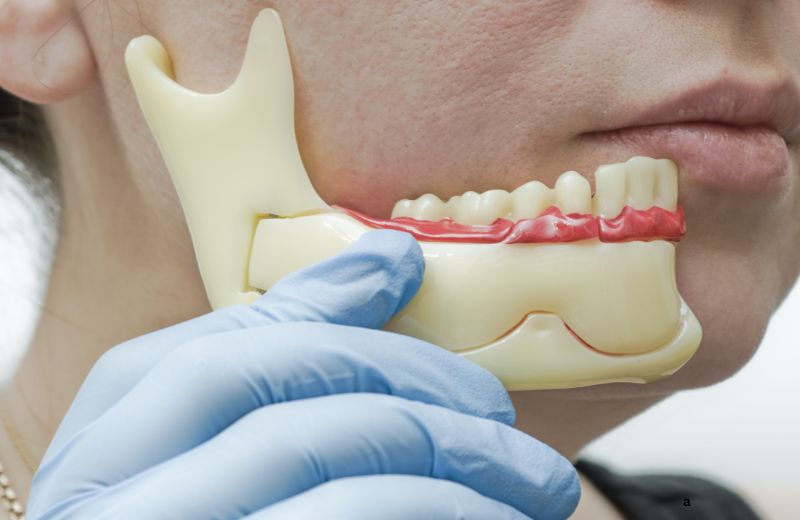 TMJ & Jaw Joint Disorder Treatments